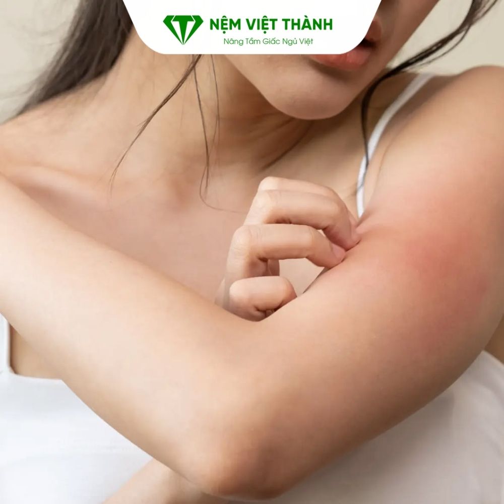 Nệm foam latex phù hợp người dễ bị dị ứng về da
